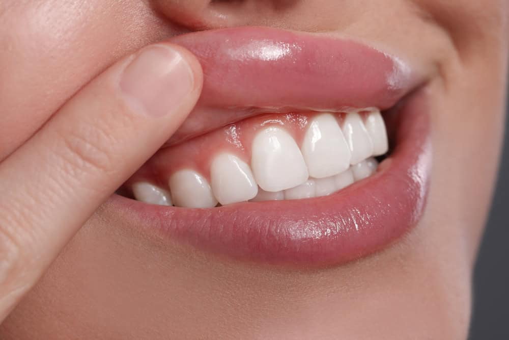 Why Is It Important To Have Healthy Gums?