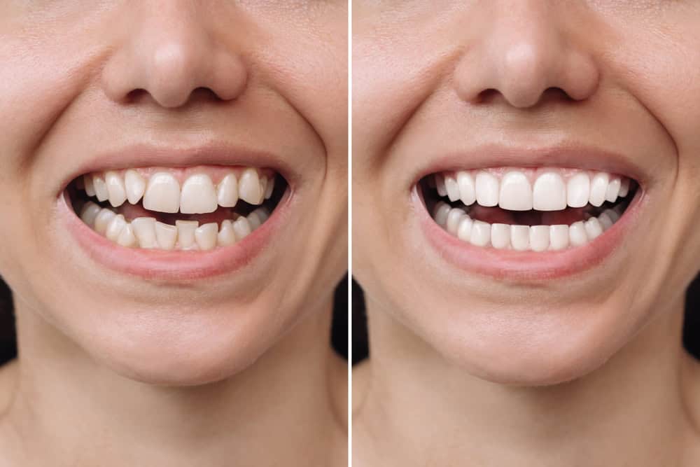 Is Cosmetic Dentistry Worth It?