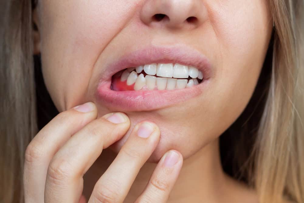 Dental Emergencies: What to Do Until You Can See the Dentist