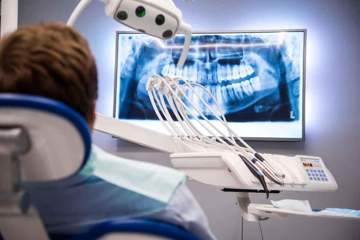 5 Benefits of Digital X-Rays